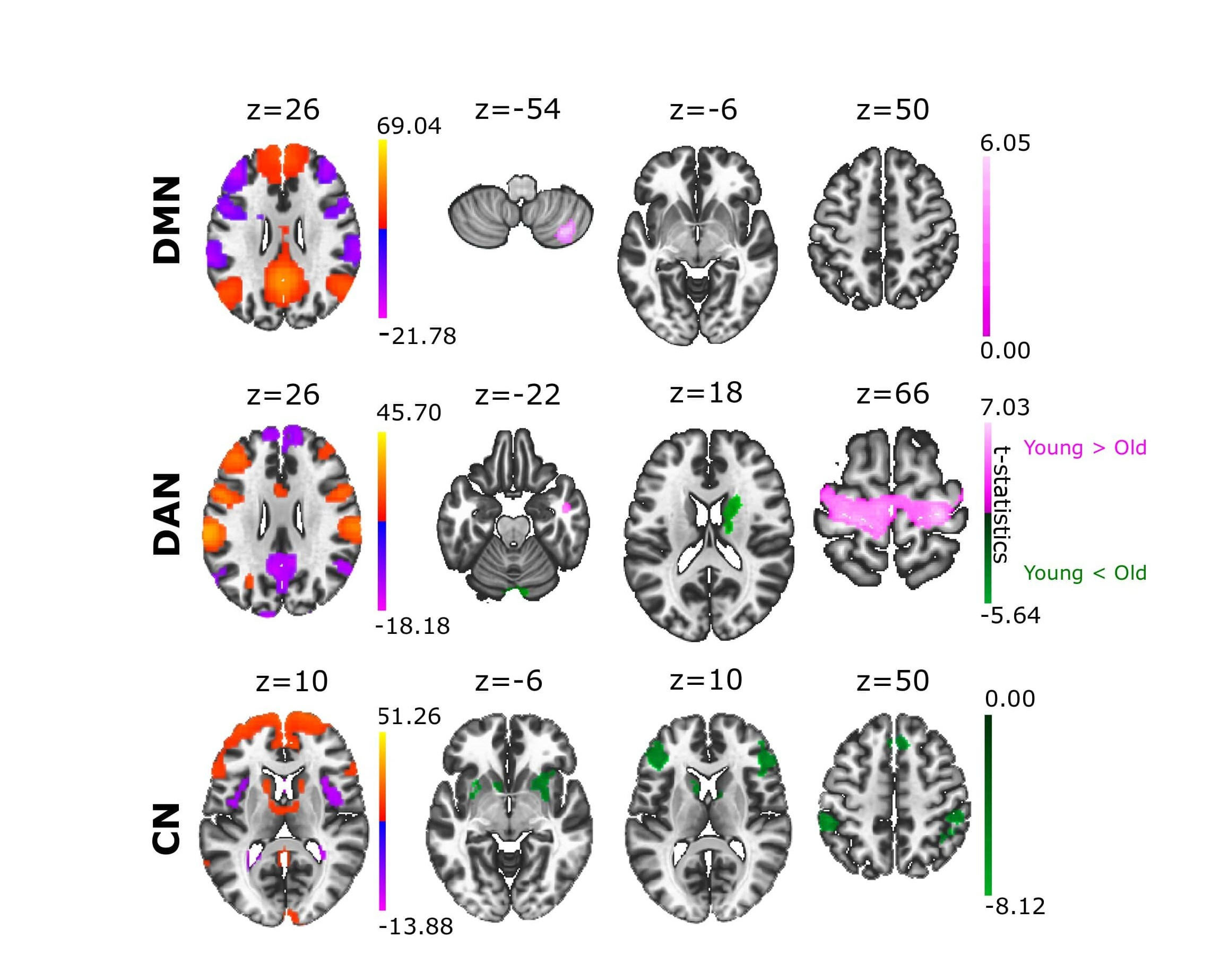 The structure of anticorrelated networks in the human brain